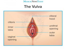Is My Vagina Normal?